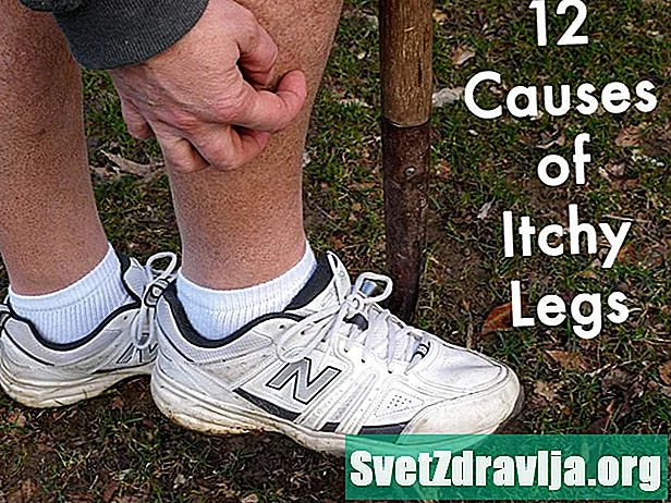 11 Przyczyny swędzących nóg i co z tym zrobić