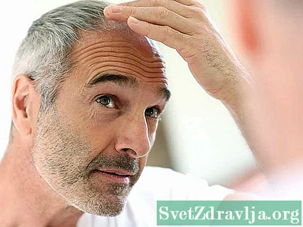 17 matu izkrišanas procedūras vīriešiem