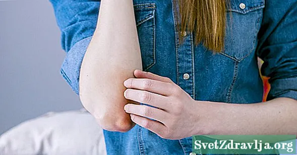 18 orsaker till en stöta på din armbåge - Wellness