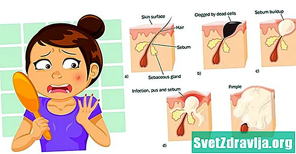 अधिक त्वचेसाठी 18 उपाय