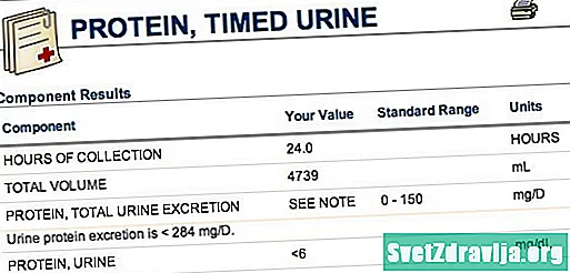 Test 24 orë në proteinën e urinës - Shëndetësor