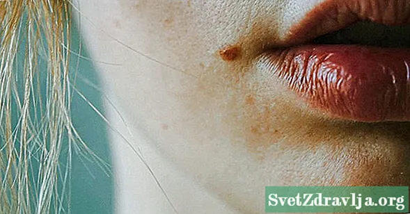 4 Cara Meratakan Bibir Tidak Rata