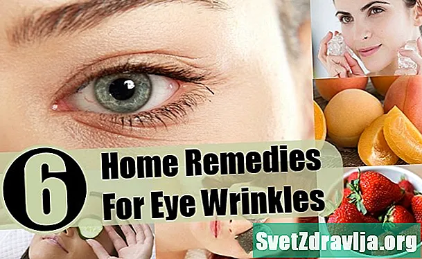 6 rimedi casalinghi per le infezioni agli occhi: funzionano?