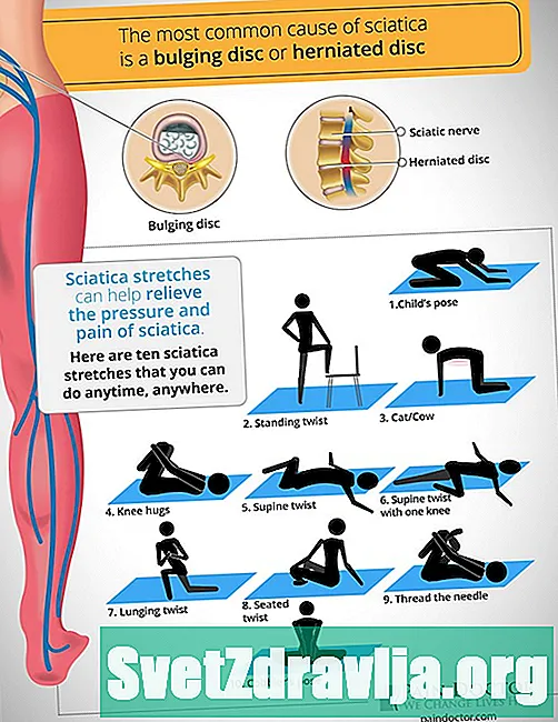 6 strekk for Sciatica smertelindring