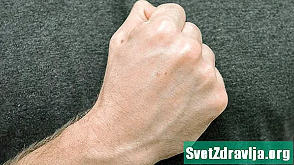 7 Rankų pratimai, siekiant palengvinti artrito skausmą