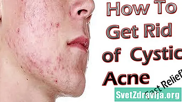7 Remeis casolans per a l’acne quístic - Salut