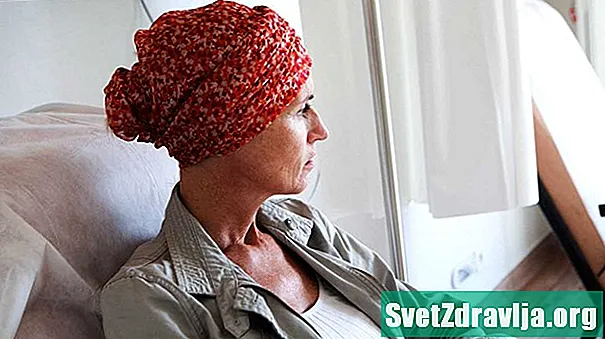 7 tudnivaló a kemoterápiás hajhullás kezeléséről