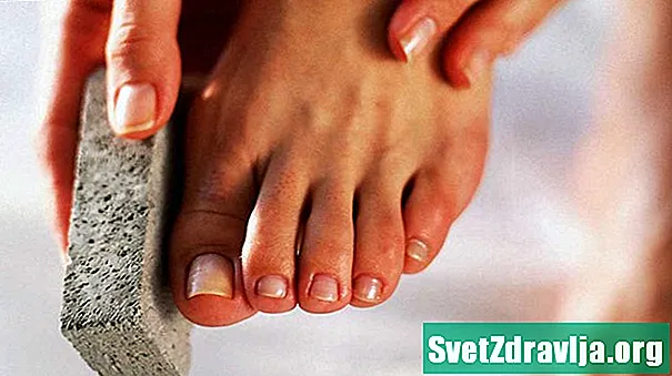 7 façons d'enlever la peau morte de vos pieds