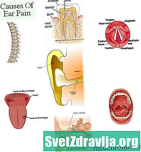 8 causes de douleur à l'oreille et à la mâchoire - Santé