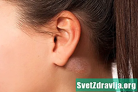 8 Årsager til klumper bag ørerne - Sundhed