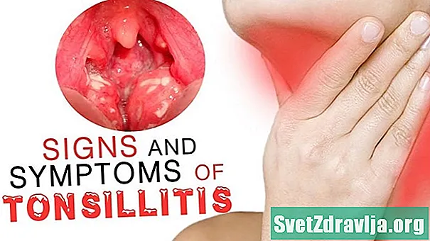 9 semne și simptome ale sindromului intestinului iritabil (IBS)
