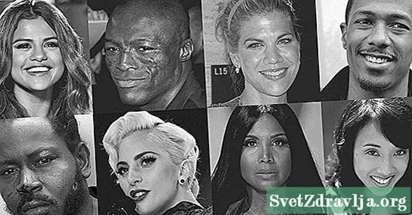 9 Persone famose con il Lupus