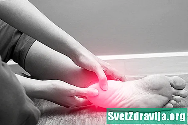 Болка в стъпалото: Управление на болката в краката на PSA