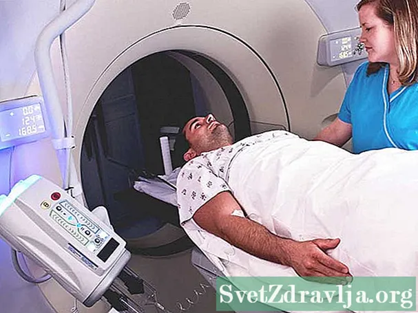 Abdominale CT-scan
