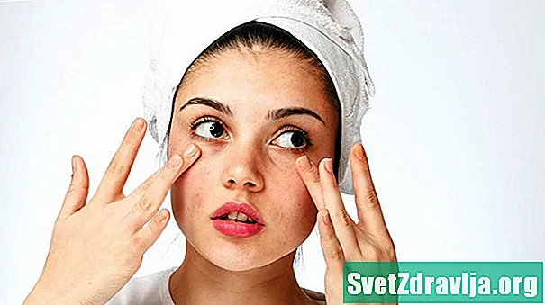 Về khuôn mặt: Cách xử lý da khô dưới mắt