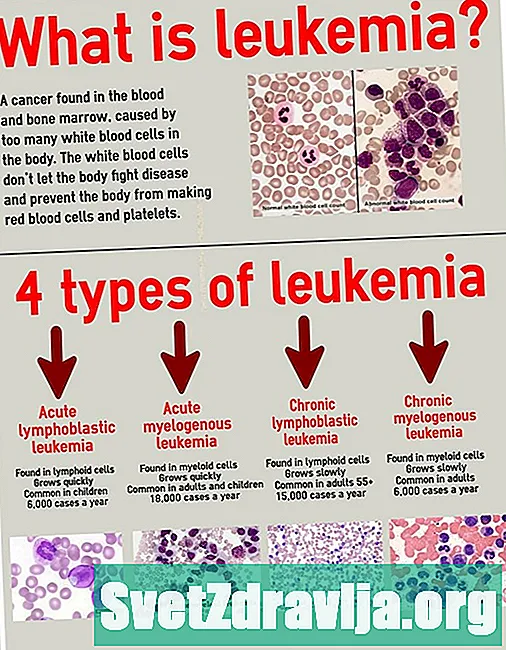 Leucémie vs lymphome: quelle est la différence?
