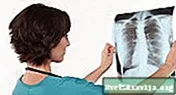 Akutni bronhitis: simptomi, vzroki, zdravljenje in še več