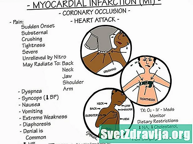 Инфраксияи шадиди миокард