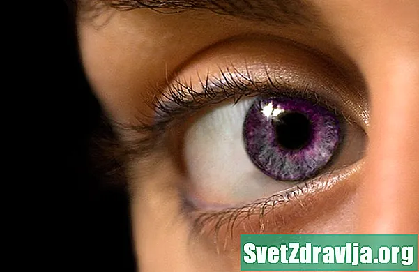 Alexandria genees: kas teie silmad võivad tõesti värvi muuta? - Tervis