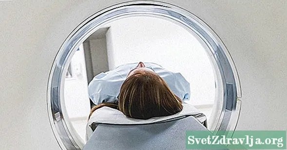 Ĉio Pri Radiologie Izolita Sindromo kaj Ĝia Ligo al Multloka Sklerozo - Sano