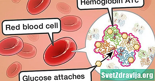 Všetko o teste hemoglobínu A1C - Zdravie