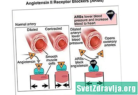 Ангиотензин II Блокаторҳои ретсепторҳо (ARBs) - Саломатӣ
