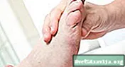 Knöchelpéng: Isoléiert Symptom, oder Zeeche vun Arthritis?