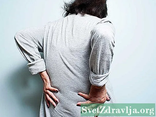 Ankiloserende spondilitis: 'n oorsaaklike oorsaak van blywende rugpyn