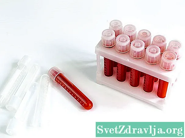 Test antimitohondrijskih antitijela (AMA)