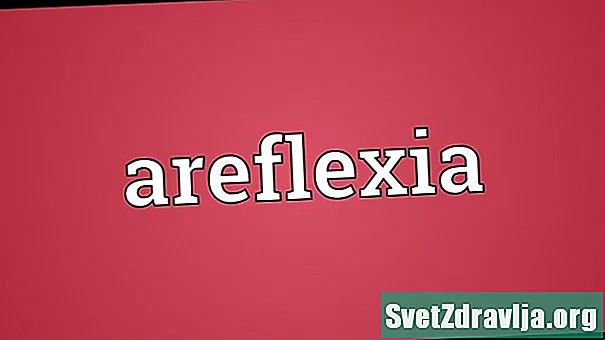 Areflexia