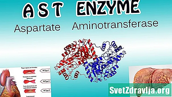 Санҷиши Aspartate Aminotransferase (AST) - Саломатӣ