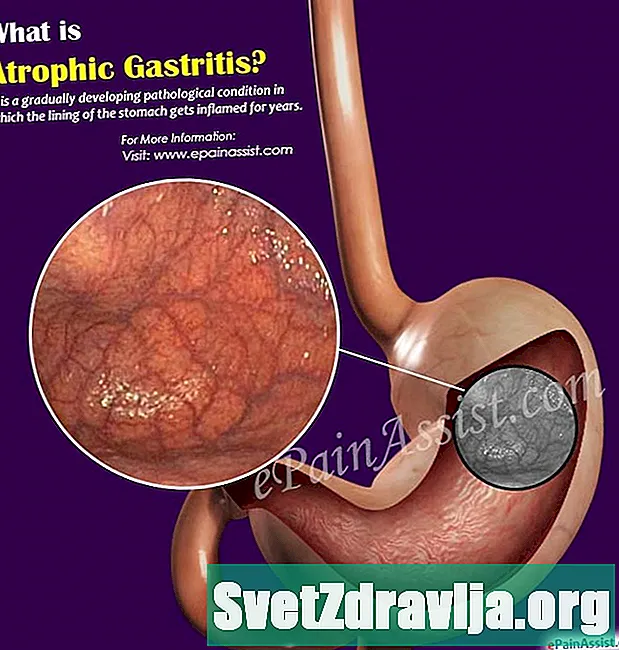 Gastrite atrófica: causas, sintomas e tratamento