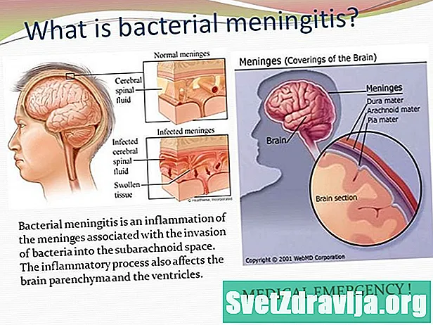 Bakterial meningit: sabablari va tarqalishi