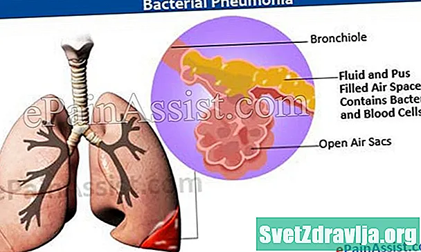 Baktēriju pneimonija: simptomi, ārstēšana un profilakse