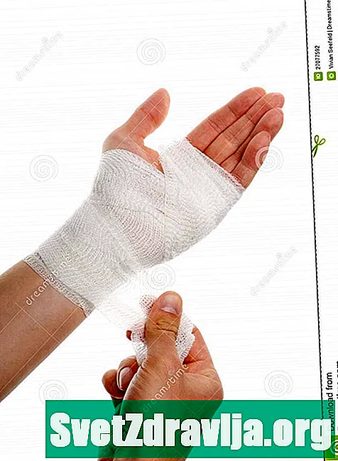 Povijanje roke po poškodbi