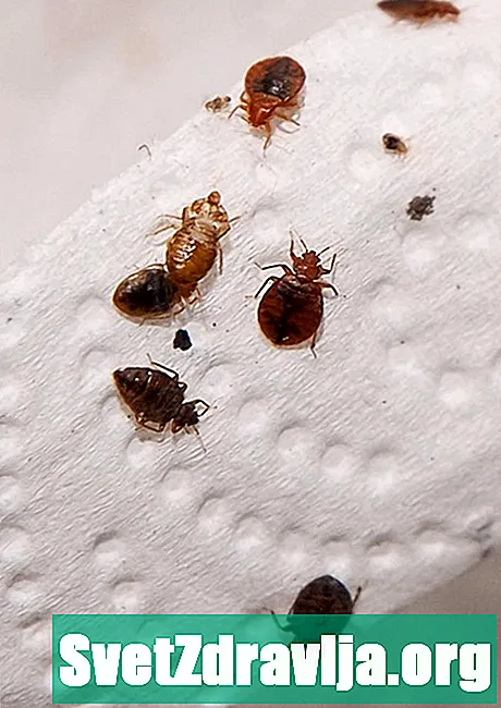 Bedbugs: Mengapa Mereka Menginfeksi Rumah Anda dan Bagaimana Menghilangkannya - Kesihatan