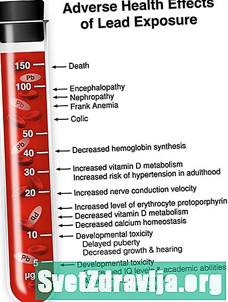 Test i niveleve të plumbit të gjakut - Shëndetësor