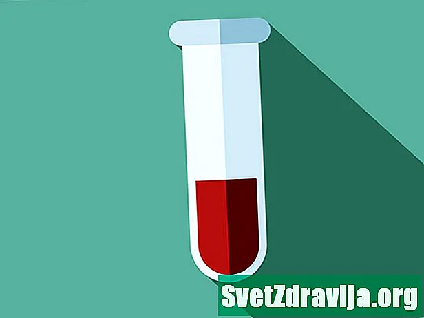 Veren natriumtesti - Terveys