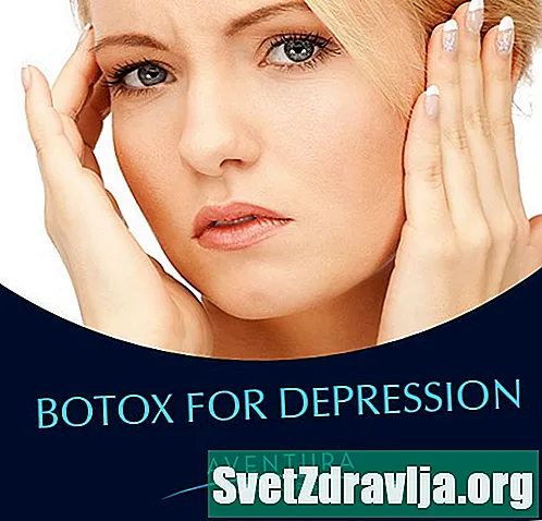 Botox për Depresionin: Si funksionon?
