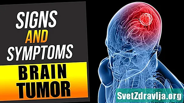 Shenjat e paralajmërimit të tumorit në tru dhe simptomat që duhet të dini - Shëndetësor