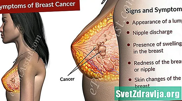 Bröstcancer Symptom Grunder