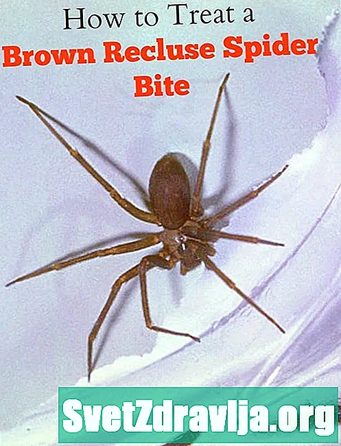 Braune Recluse Spider Bites: Wat Dir sollt Wësse - Gesondheet