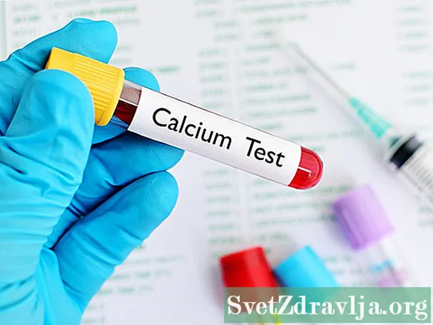 Calcium sanguis test