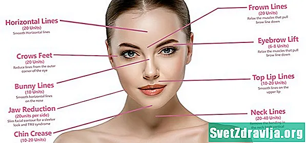 Môže vám Botox poskytnúť štíhlejšiu tvár? - Zdravie