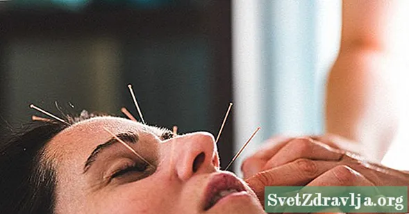 An féidir le acupuncture facial aghaidh a thabhairt ort i ndáiríre níos óige?