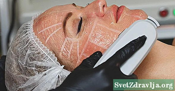 A nagy intenzitású, fókuszált ultrahangos kezelés helyettesítheti-e az arclemezeket? - Wellness