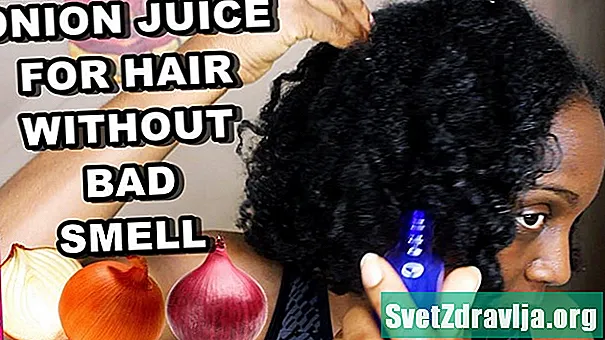 Ali lahko čebulni sok ustavi izpadanje las?
