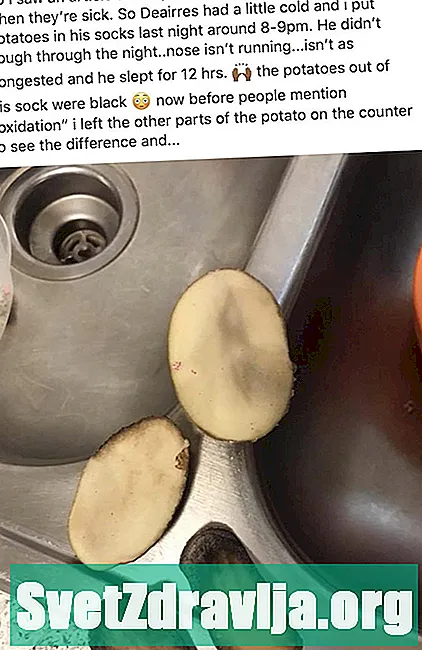 Vai kartupeļi jūsu zeķēs var izārstēt saaukstēšanos vai citas kaites?
