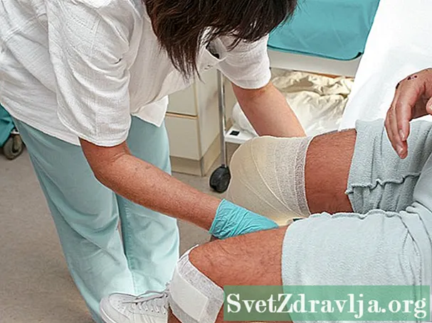 Може ли терапијата со матични клетки да ги поправи оштетените колена?