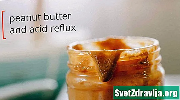 Können Sie Erdnussbutter essen, wenn Sie sauren Reflux haben?